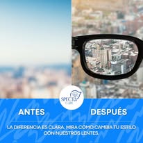 Comparativo de visión antes y después